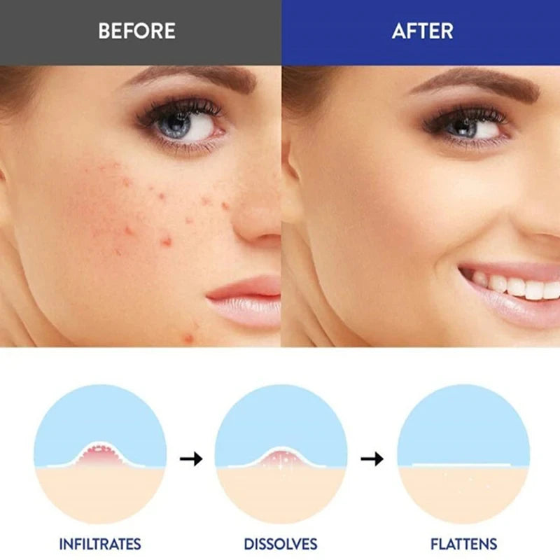 Nuestro producto en uso